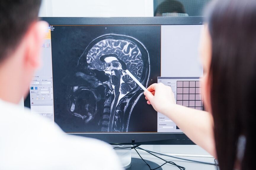 Two people examining a brain scan